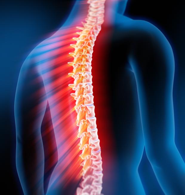 Back pain Back pain