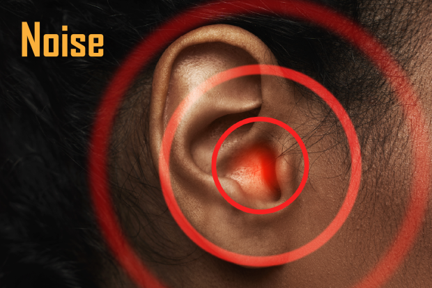 Hearing loss Hearing loss