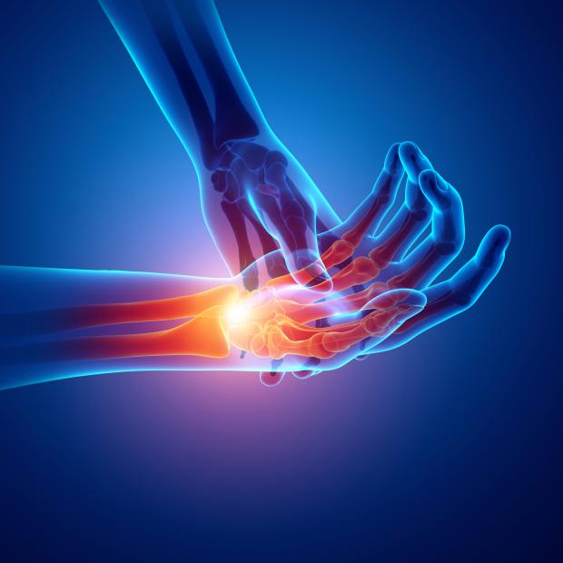 Wrist pain Wrist pain